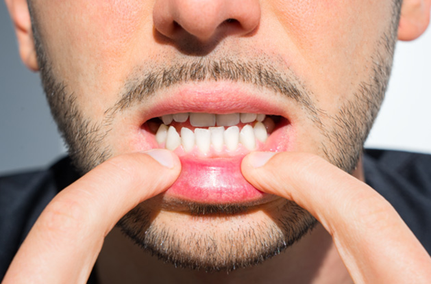 a close-up of a patient with crooked teeth