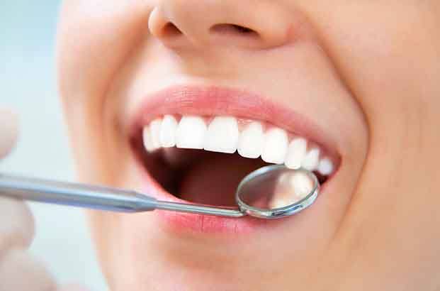 Nose-to-chin view of a dental mirror being held to a woman’s teeth