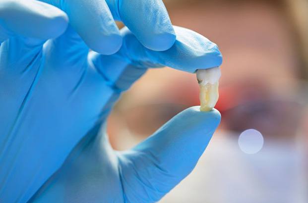 Close-up of gloved hand holding extracted tooth