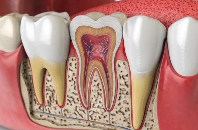 Cutaway rendering of the nerves and roots of a tooth in a lower arch