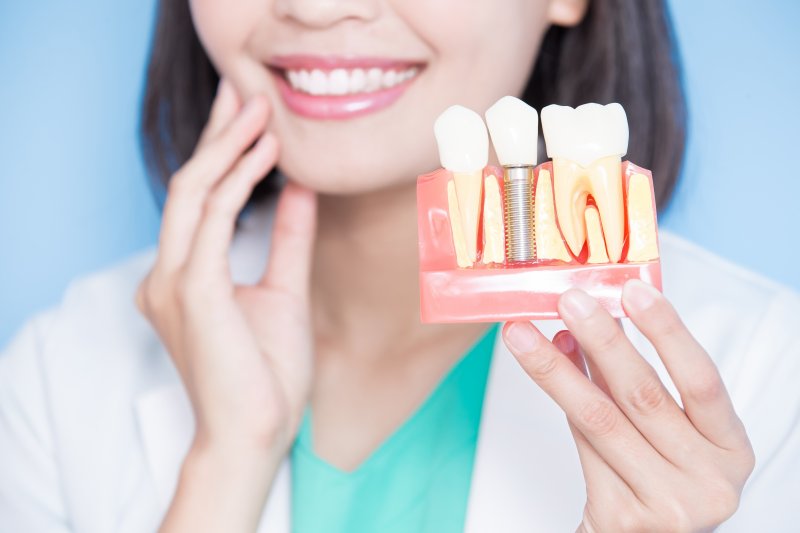 A dentist holding an enlarged dental implant model